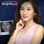 Nguyễn Hoàng Oanh – Cô “vịt xấu xí” trở thành “thiên nga” sau HTLX 2018