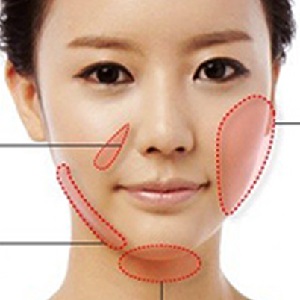 Cấy mỡ mặt bằng mỡ tự thân – Giải pháp dành cho những ai thiếu mỡ trên mặt