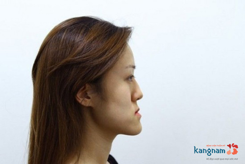 Khuôn mặt lưỡi cày như thế nào