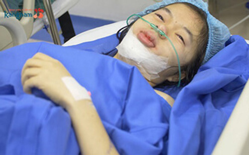 phẫu thuật gọt mặt lưỡi cày