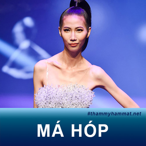 Má hóp vì sao? Má hóp để tóc gì đẹp? 3 Cách làm đầy má hóp vĩnh viễn