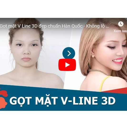 Video gọt mặt V line ở Kangnam của khách hàng – Khắc phục hàm vuông thô bạnh