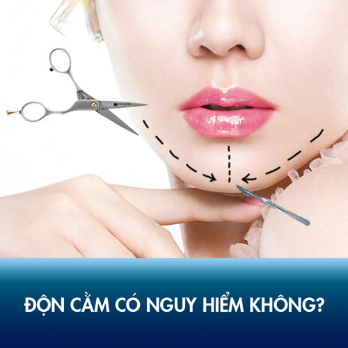Độn cằm có nguy hiểm không? Có gây hại hay ảnh hưởng gì về sau không?