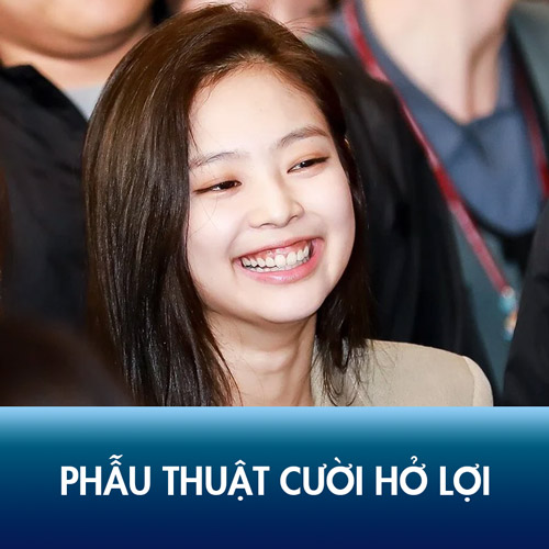 Phẫu thuật cười hở lợi – 60 phút lấy lại nụ cười tự tin, rạng rỡ
