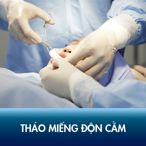 Những thông tin cần biết trước phẫu thuật tháo miếng độn cằm