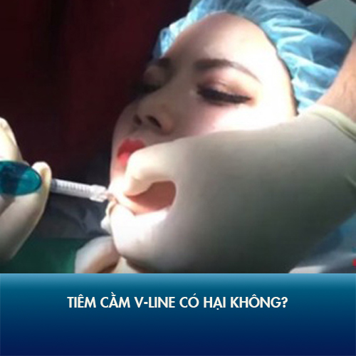 Tiêm cằm V line có hại không? 4 yếu tố quyết định tiêm filler an toàn