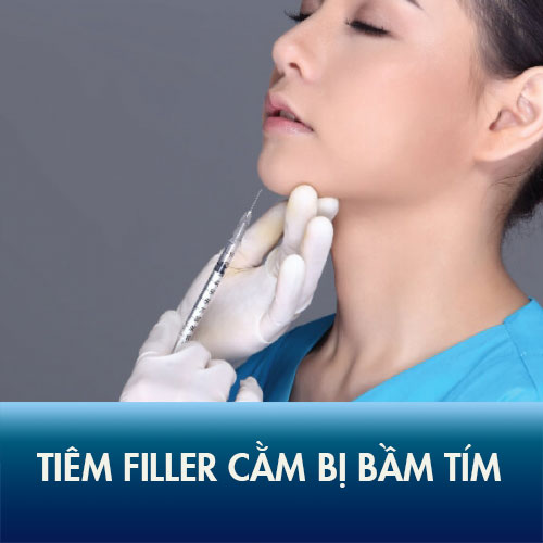 [Cẩn trọng] Tiêm filler cằm bị bầm tím – Nguyên nhân và cách khắc phục tốt nhất!