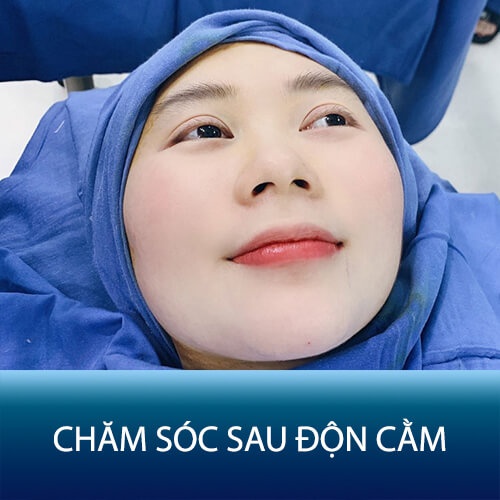 Hướng dẫn chăm sóc sau độn cằm sao cho đúng cách